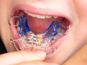 Orthodontics Snellville Ga